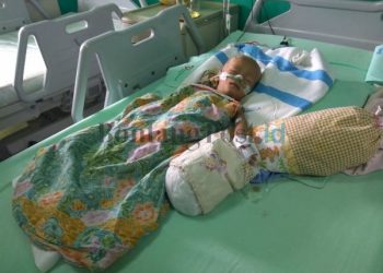 Tak Miliki Biaya Berobat, Ahmat Alfiansyah, Bayi Pengidap Gizi Buruk dan Paru-paru  Butuh Uluran Tangan