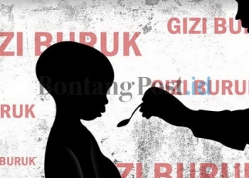 Kasus Gizi Buruk Masih Ditemukan