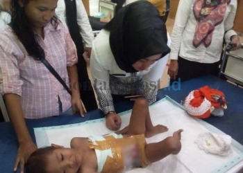 DIRAWAT: Nurul dirawat di RSUD Kudungga, Sangatta Utara, Kamis (23/3) kemarin. Usus bocah malang ini ke luar dari perut setelah menjalani proses operasi, empat bulan lalu. (DEDY SANGATTA POST)