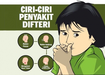 KLB Difteri, Bupati Minta Diskes Respon Cepat