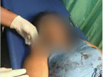 SADIS!!! Suami Bacok Istri hingga Tewas 