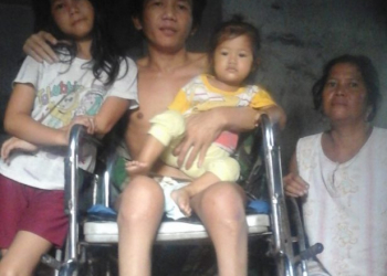 21 Tahun di Kursi Roda, Tiyong Benar-benar Menderita