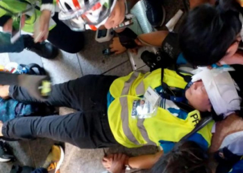 Veby Mega Indah saat mendapat perawatan medis lantaran terkena peluru karet dari aparat kepolisian Hongkong (The Straits Times/SCMP)