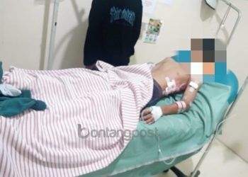 Kesaksian Rekan Korban yang Diterkam Buaya; Dikira Bercanda, Lawan dengan Tangan Kosong