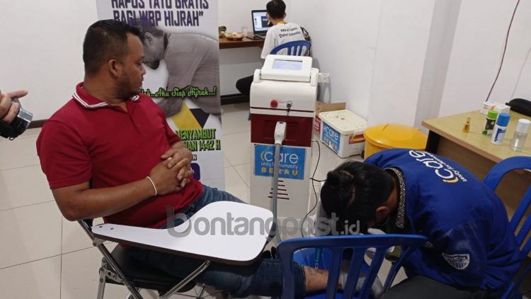 Salah seorang warga binaan yang mengikuti program hapus tato. Ini merupakan program kolaborasi Lapas Bontang dan lembaga kemanusiaan iCare Bontang. (Fitri Wahyuningsih/bontangpost.id).