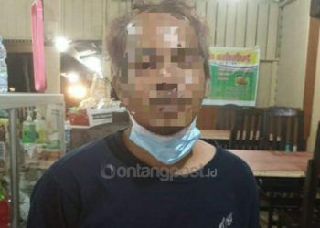 Bawa Kabur Mobil Teman, Korban Dipukul dan Dicekik