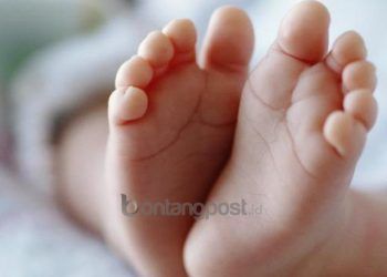 Bayi 3 Bulan Berjuang Melawan Covid-19; Punya Komorbid, Pakai Alat Bantu Pernapasan
