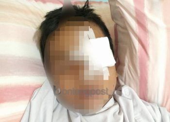 Perang Sarung Makan Korban, Terkena Serpihan Kayu, Mata Kiri Diangkat