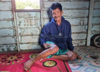 Cerita Latahang, Korban Selamat Usai Digigit Buaya Guntung