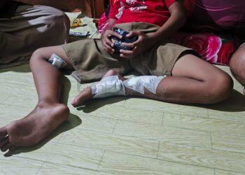 Kronologi Serangan Buaya di Tanjung Limau Bontang; Luka Menganga di Dua Kaki