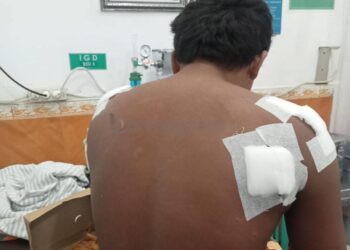 Nelayan Diterkam Buaya di Perairan Pulau Kedindingan Bontang, Alami Luka Serius di Kedua Bahu